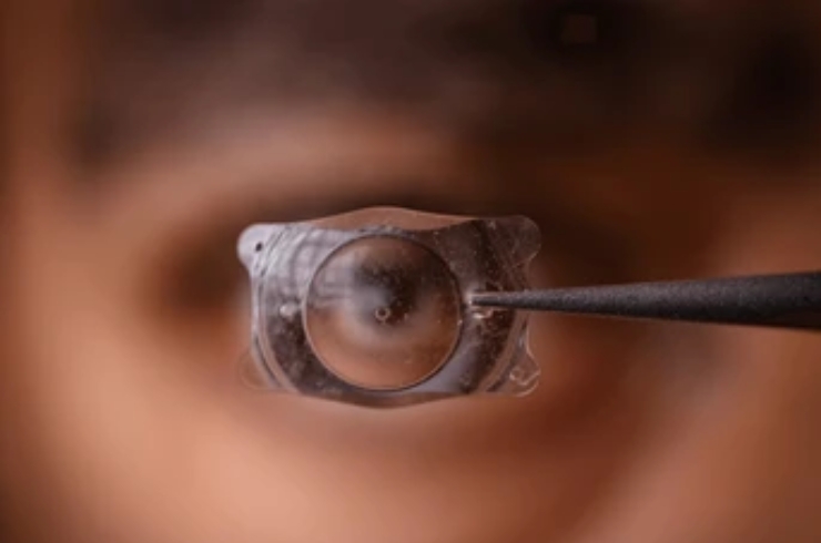 ICL Vision Correction------28