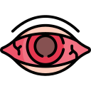 Uveitis Care Services